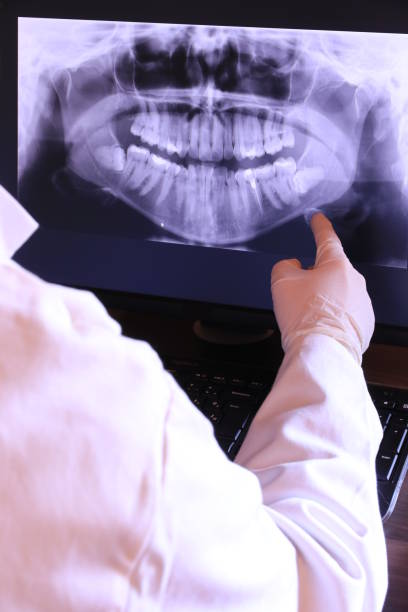 Best Emergency Wisdom Tooth Extraction in Waipio, HI