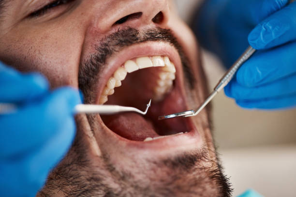 Best Emergency Treatment for Oral Infections in Waipio, HI