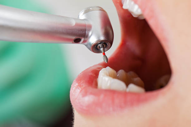 Best Emergency Treatment for Oral Infections in Waipio, HI